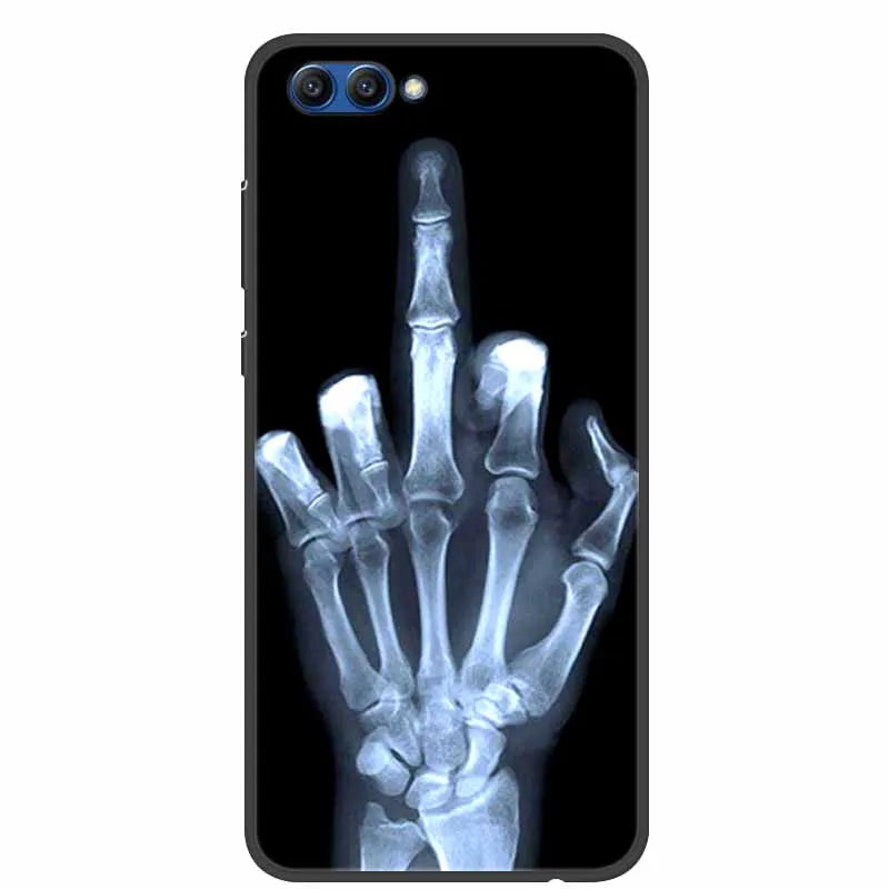 For Honor View 10 Case Luxury Silicone TPU Soft Cover Phone Case For Huawei Honor V10 Funda Shockproof Fashion Cartoon Coque